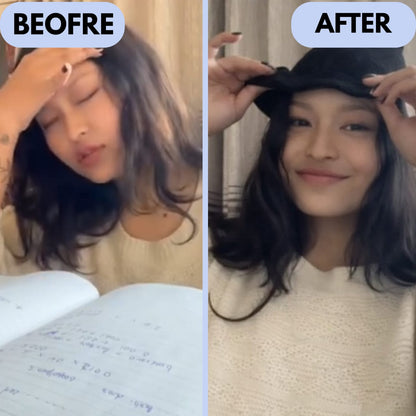 Relivo™ Migraine Relief Cap