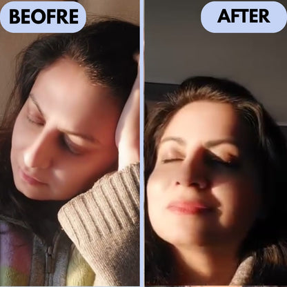 Relivo™ Migraine Relief Cap